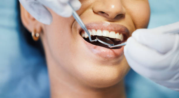 Best Weekend Emergency Dental Services in Lake Camelot, IL