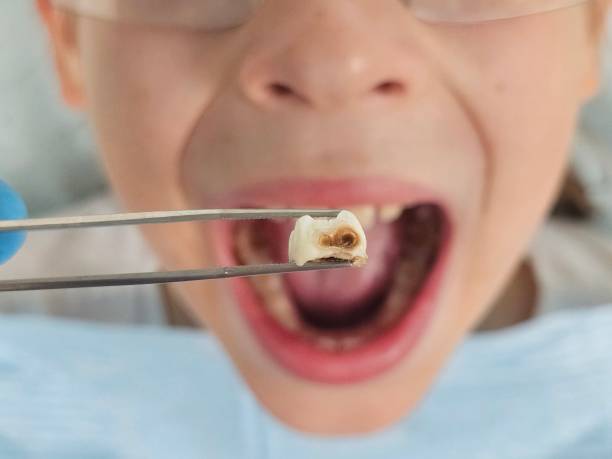 Best Emergency Denture Repair in Lake Camelot, IL